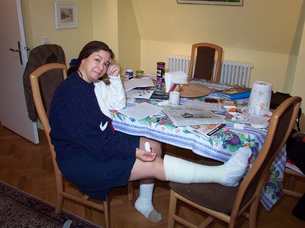 December - Broken Leg